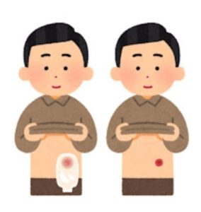 ストーマ周囲皮膚障害を防ぐ観察ポイントと対策